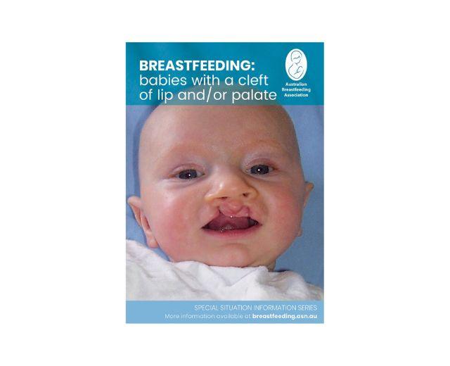 Breastfeeding babies with a cleft of lip and or palate Australian Breastfeeding Association